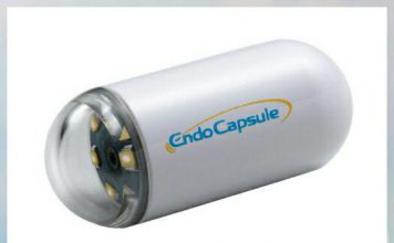 جایگزین آندوسکوپی