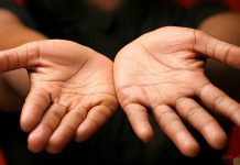 با نگاه به کف دست خود، نشانه هایی از سلامت خود را بدست آورید